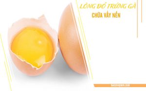 trị vẩy nến bằng lòng đỏ trứng