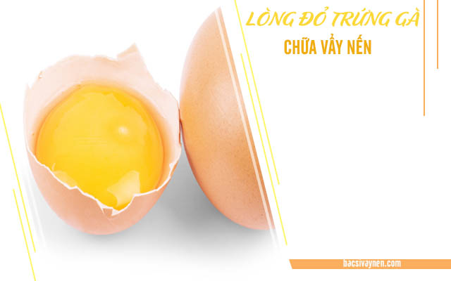 Cách chữa vẩy nến bằng lòng đỏ trứng