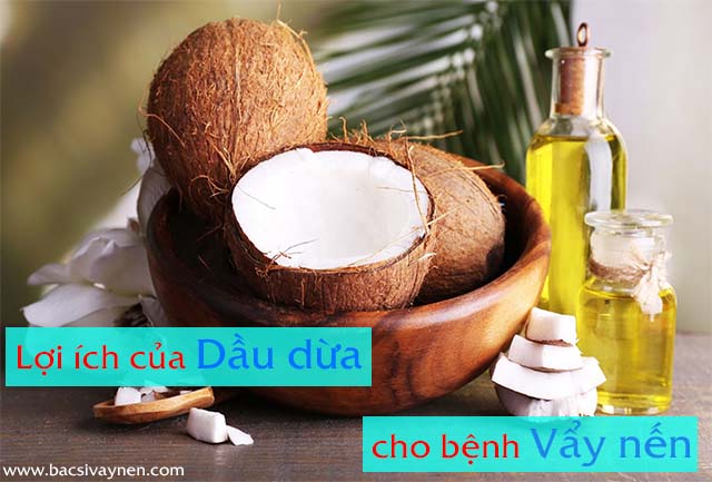 Dầu dừa chữa bệnh vẩy nến