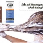 dầu gội Neutrogena trị vẩy nến tốt không