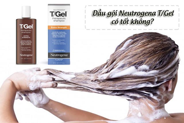 dầu gội Neutrogena trị vẩy nến tốt không