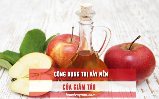 cách chữa vẩy nến bằng giấm táo