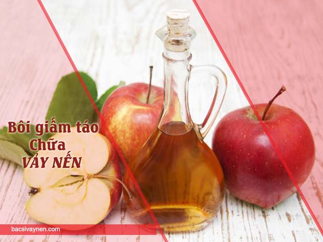 bôi giấm táo lên da có thể chữa vảy nến