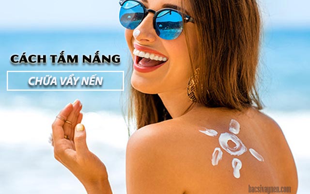 cách tắm nắng chữa vẩy nến