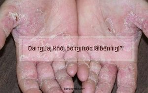 vì sao da bị ngứa và bong tróc