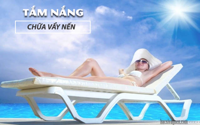 tắm nắng trị vẩy nến