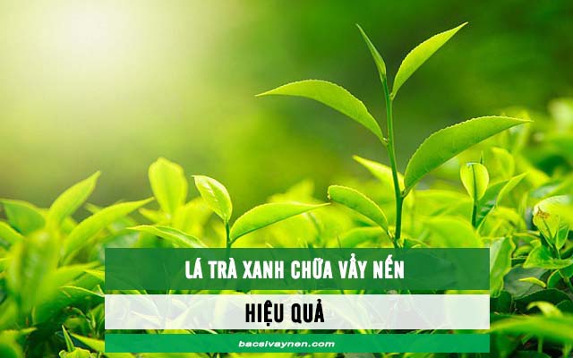 Lá trà xanh chữa bệnh vẩy nến