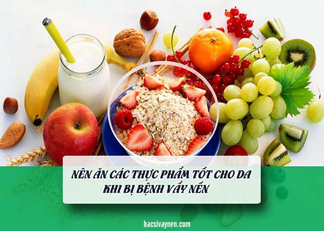 chế độ ăn uống là cách hỗ trợ trị vẩy nến tại nhà