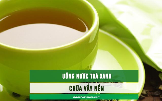 chữa vẩy nến bằng nước trà xanh