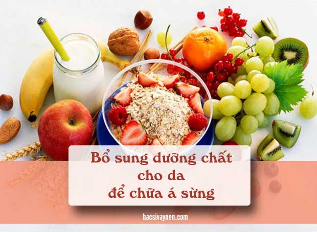 chế độ ăn uống hỗ trợ điều trị bệnh á sừng