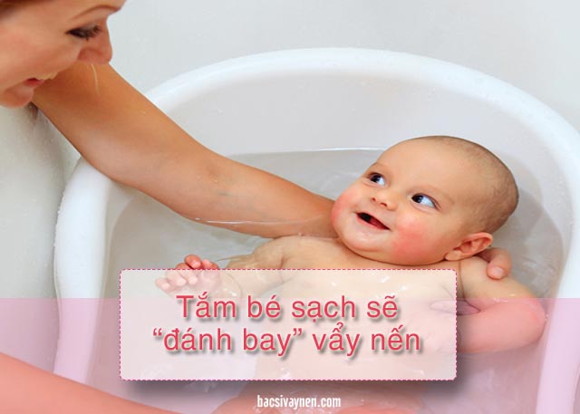giữ vệ sinh da cho trẻ sơ sinh bị vẩy nến