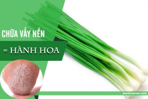 dừng hành hoa chữa vẩy nến