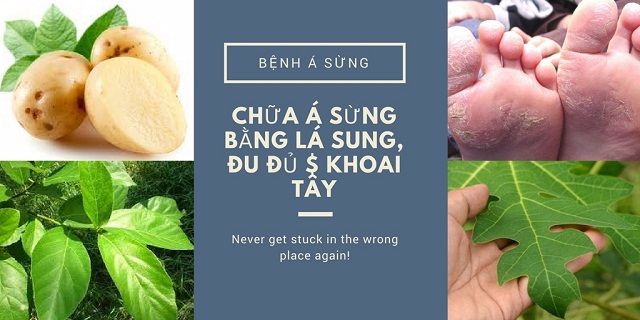 Chữa á sừng ở chân bằng đu đủ, khoai tây và lá sung