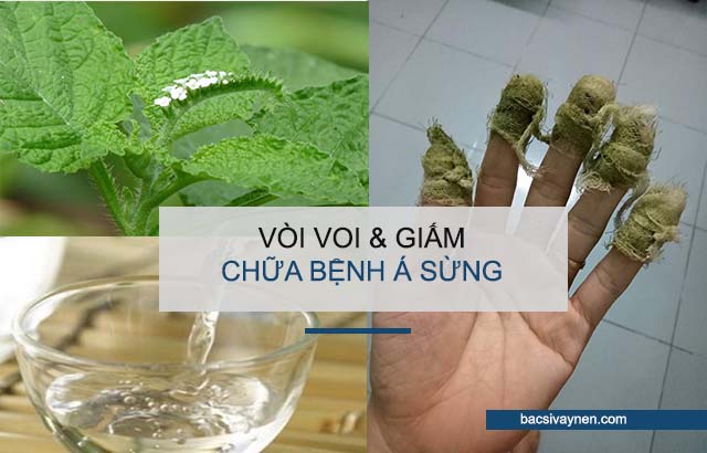 Giâm và vòi cây voi có chữa được bệnh á sừng không?