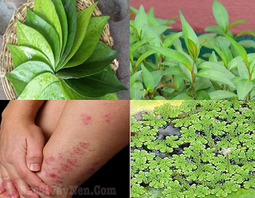 Bài thuốc chữa bệnh vẩy nến