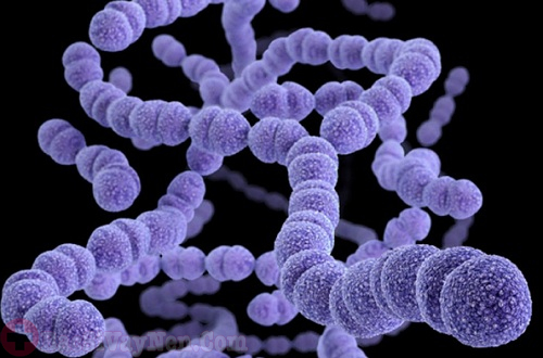 Bệnh vẩy nến thể giọt do vi khuẩn Streptococcus