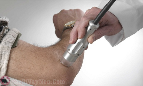 Điều trị bệnh vẩy nến ở chân tay bằng liệu pháp ánh sáng