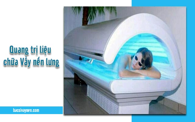 trị vẩy nến ở lưng bằng phương pháp quang trị liệu