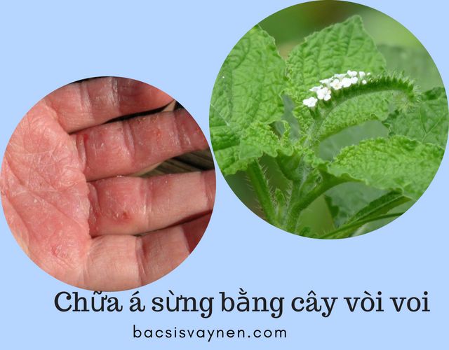 Lá vòi voi chữa bệnh á sừng