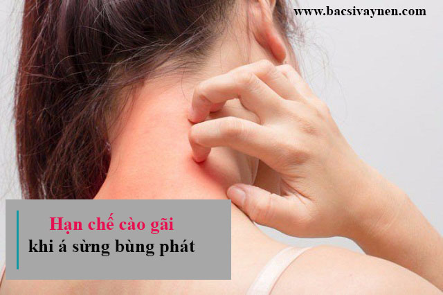 Hạn chế cào gãi khi bị bệnh á sừng