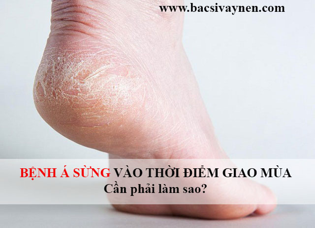 Bệnh á sừng giai đoạn chuyển mùa