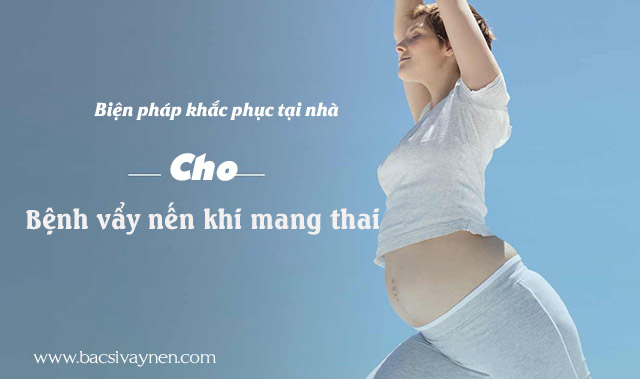 Biện pháp khắc phục bệnh vẩy nến