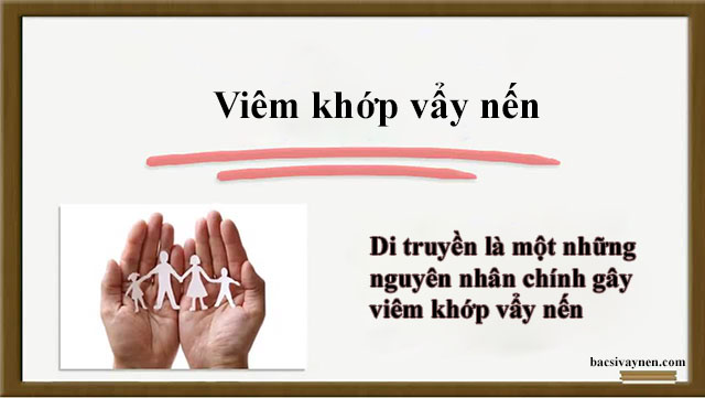 Viêm khớp vẩy nến do đâu