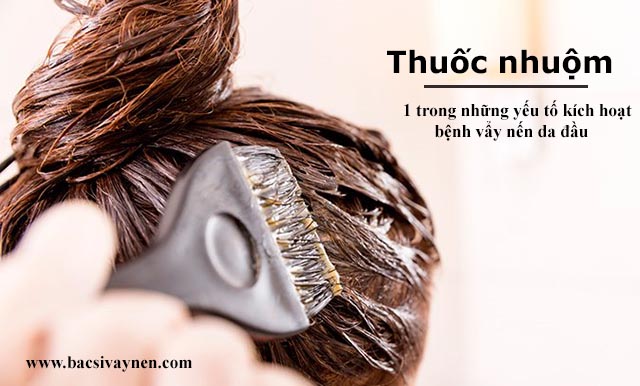 Yếu tố kích hoạt cho bệnh vẩy nến da đầu