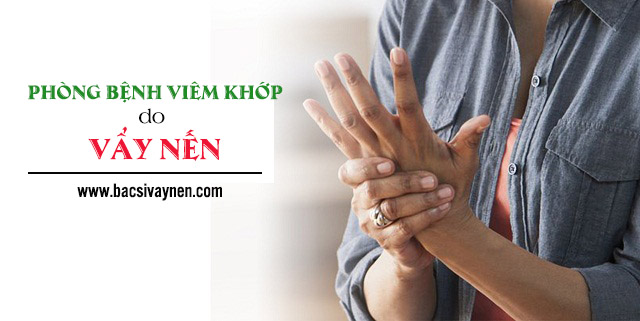 Cách phòng bệnh viêm khớp do vẩy nến