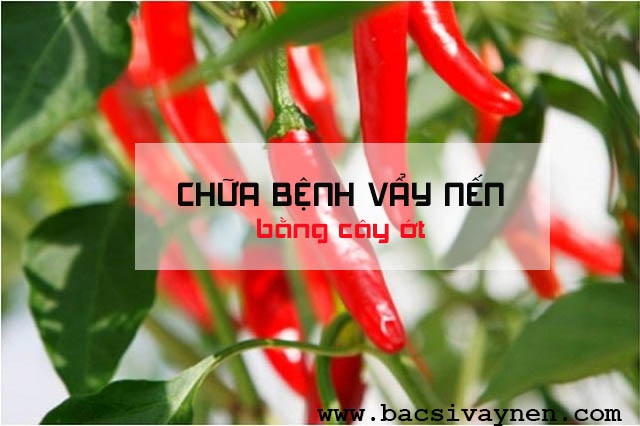 chữa bệnh vẩy nến bằng cây ớt