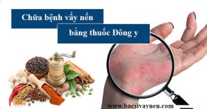 Chữa bệnh vẩy nến bằng Đông y