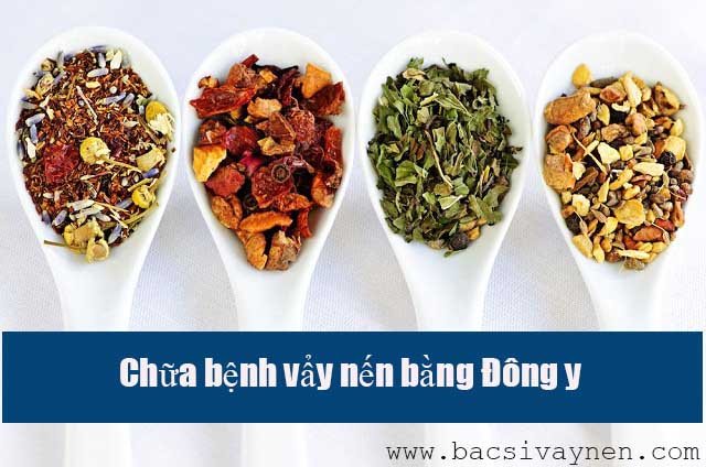 Chữa bệnh vẩy nến bằng Đông y