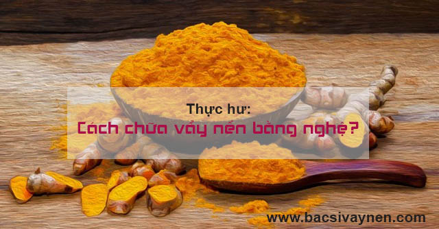 Cách chữa bệnh vẩy nến bằng tinh bột nghệ