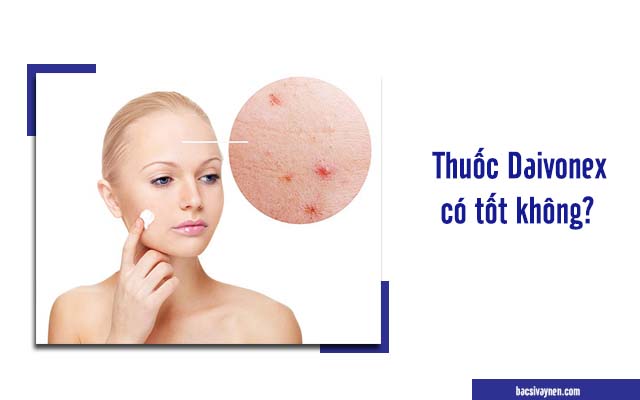 chia sẻ của người dùng về Daivonex