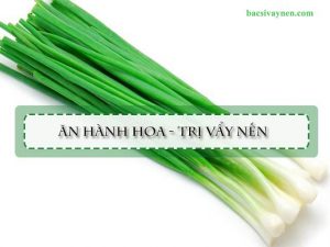 Cách chữa bệnh vẩy nến bằng hành hoa