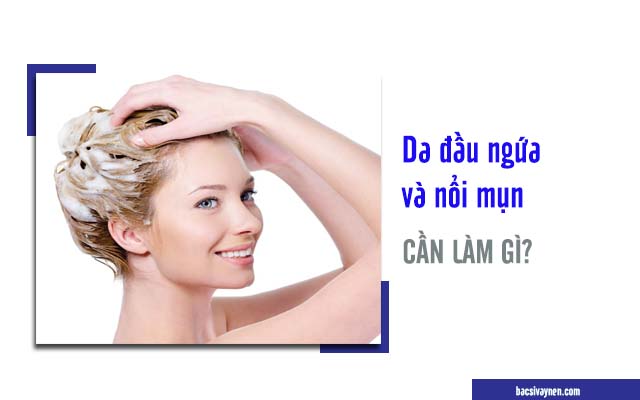 cần làm gì khi da đầu bị ngứa và nổi mụn