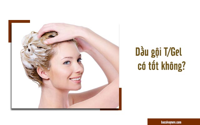 review dầu gội trị vẩy nến T/Gel