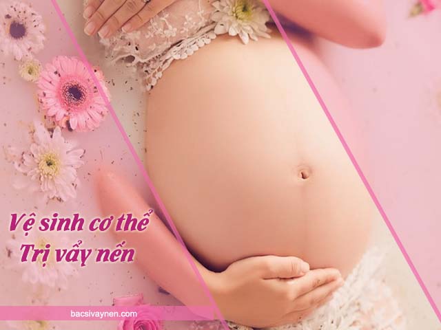 trị vẩy nến an toàn cho phụ nữ mang thai