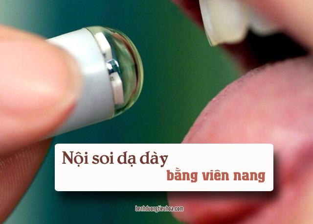 viên nang nội soi dạ dày